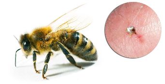 Kompozisyon Hondrostrong girer, arı zehiri, bir artırır ve dokularda metabolik süreçleri