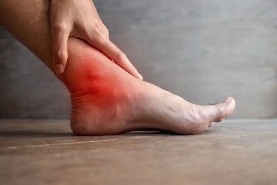 ayak bileği ekleminin artrozu