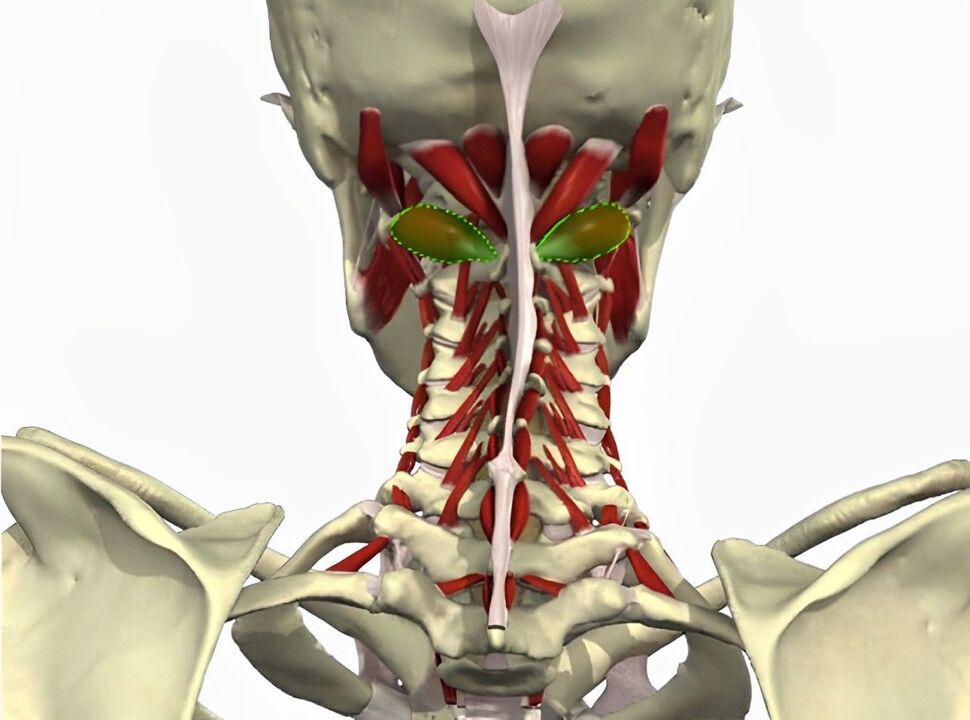 vertebral arter sendromu